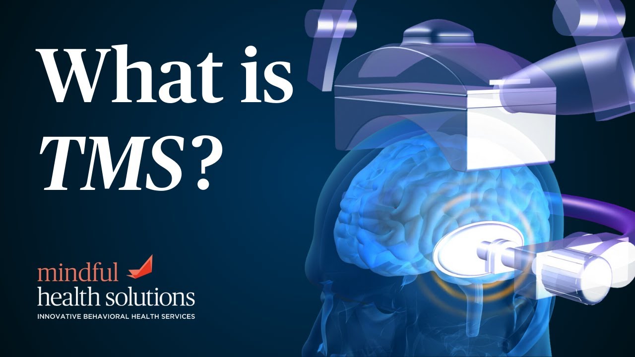 What is TMS? How TMS Works to Treat Depression